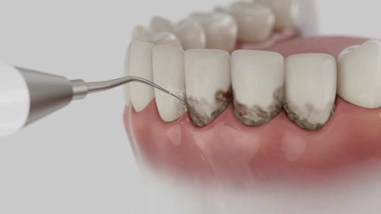 Trusted Teeth Cleaning And Checkup service in Eureka, CA - Dentist Open Now